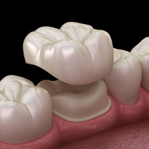 REHABILITACIÓN ORAL